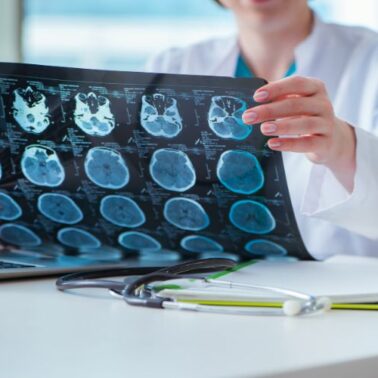 Post image How Advanced MRI Imaging has Revolutionised Healthcare
